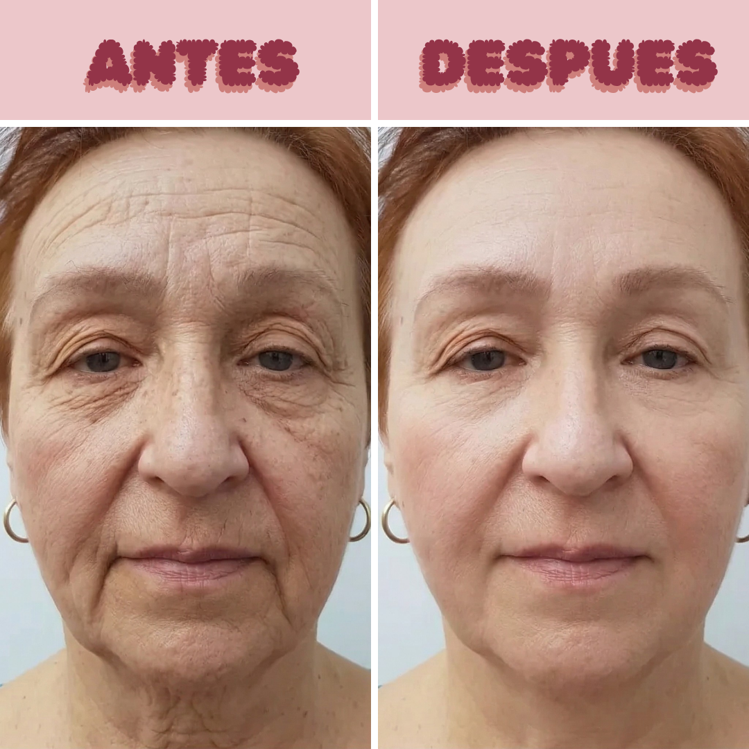 👧Colágeno Hidrolizado